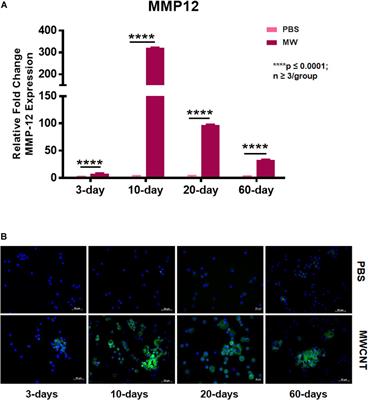 Matrix Metalloproteinase-12 Is Required for Granuloma Progression